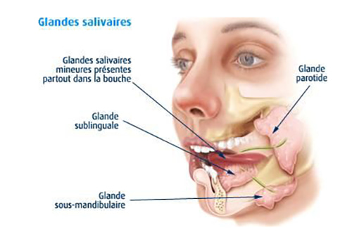 Sous Maxillectomie | Chirurgie de la glande sous maxillaire