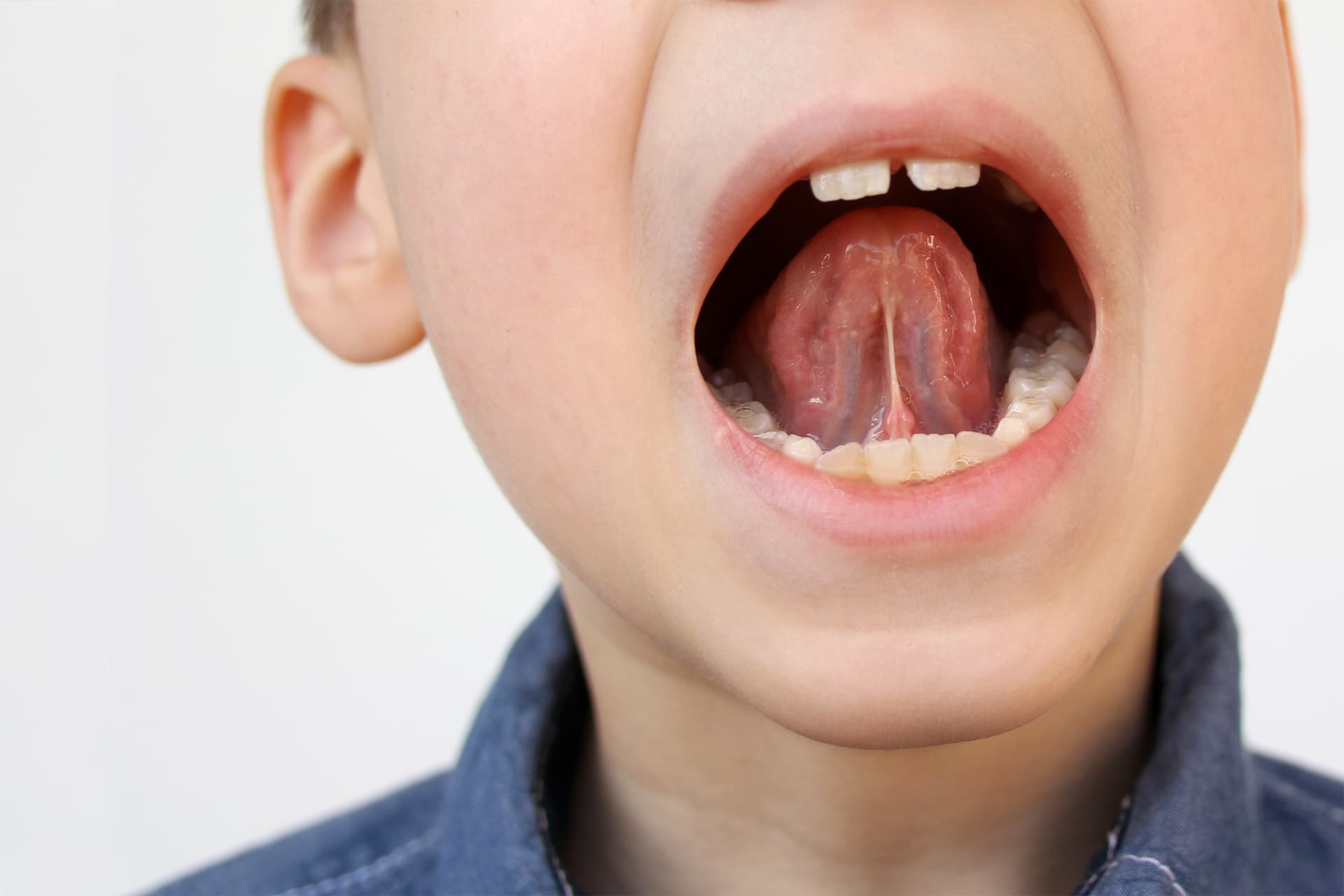 Frenulo Labial Inferior Frenulum Of The Tongue Wikipedia